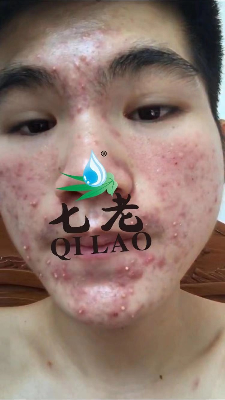 20190324181622_13260.jpg 微信图片_20190224204745.jpg