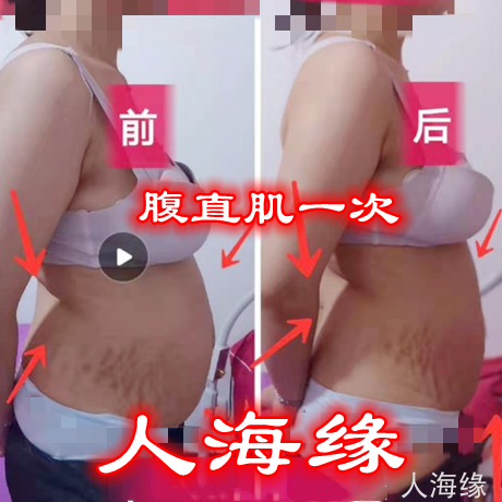腹直肌