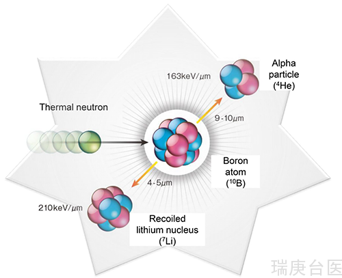 BNCT | 硼中子俘获疗法脊髓肿瘤放疗新选择