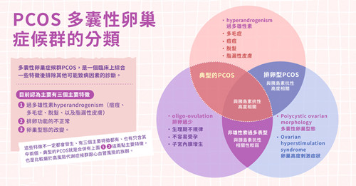 掌握 3 个主要特征！ 饮食、运动、药物多管齐下 与多囊性卵巢症候群和平共处