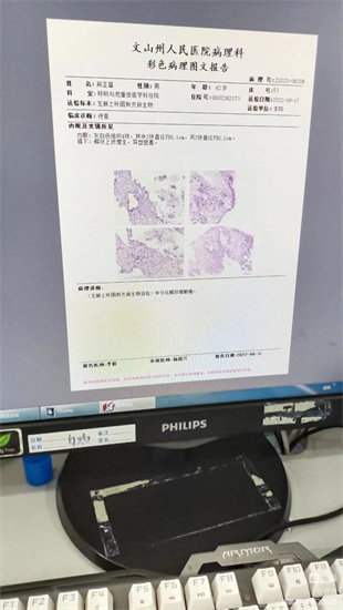 20230829150221_92347.jpg l彩超.jpg